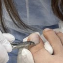 레푸스 연산점 이미지