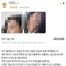 광주눈밑필러, 많이 물어보시는 2가지 질문