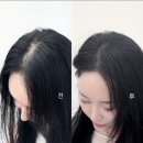 검단신도시 자연눈썹 방문후 헤어라인 정수리 두피채움 뷰티메이트 재방문 솔직후기