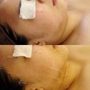 화성에너지 | 화성남양/리프팅 후기 /피부관리 /테라노바 에너지 테라피 쉐이핑업/더블업리프팅 (업에스테틱 화성남양)