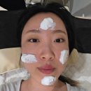 클리어레이저 | 고속터미널역피부과 울트라클리어 레이저 후기 모공 여드름 흉터 레이저 내돈내산 전후
