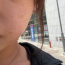 아셀 - 안양시 동안구 평촌대로374번길 9-7 | 논현동 피부관리 추천 쥬브아셀V 후기 피부결 개선이 기대되는 이유