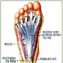 족저근막염 이미지