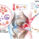 가천대 의대, 온열반응 줄기세포 이용 중증관절염 치료 세계최초 구현 이미지