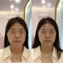 맘메디칼 | 김해 웨딩관리 작은얼굴 윤곽 데콜테 관리, 끌리메 김해점 후기