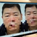 유스앤영의원 네이버블로그