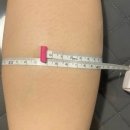 혜스테틱
