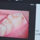 서울휴치과의원 이미지