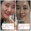 제주인셀덤 - 28416 | 체험 인셀덤무료체험 인셀덤무료샘플 파주인셀덤 일산인셀덤 김포인셀덤 제주인셀덤 인셀덤사업 인셀덤보상