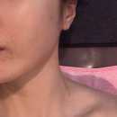 얼짱몸짱개봉역점 | 구로피부관리 얼짱몸짱 개봉역점 웨딩관리 후기