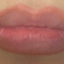 르에이치의원 이미지