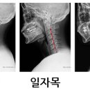 필라테스C 이미지