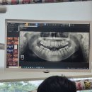 슈어치과교정과치과병원 네이버블로그