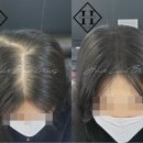 야당,야당동 두피문신 디자이너의 선택이 중요한 이유