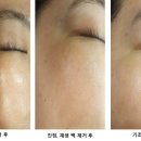 오광케어 이미지