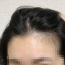 [대전] 대전 둔산 왁싱샵 레몬슈가링 여자헤어라인 왁싱 후기