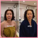 고잔2길 | 안산피부관리 살롱드보떼 엄마 효도선물 윤곽슬리밍케어 탄력선물 비포애프터 후기