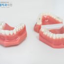엘치과의원 | 행신동틀니치과, 틀니 고민 중이라면 이 글부터 읽어보셔도 좋습니다