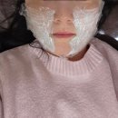 명동자연과한의원 | 서울명동 팔자잼버로 오랜 고민 팔자주름 해결한 후기 실리프팅