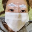 미병원 | [눈썹문신]미병원 블루컨투어 노협찬 현실 후기