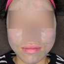 단미뷰티 | 남악피부관리 고민 해결! [단미뷰티] 솔직후기