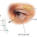 새봄안과 이미지