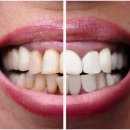 일산스타28치과의원 이미지