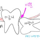 사랑니에 관한 진실!! 이미지