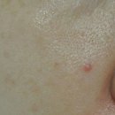 리리테라피 이미지