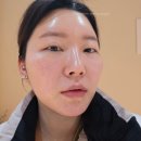 스킨바 광교호수점