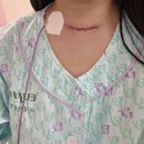 (유)응급환자이송일이구 | 20대 갑상선암 전절제: 수술 당일 기록, 수술 후 응급출혈, 재수술,수술고통(이대서울병원)