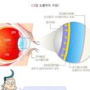 안구건조증 원인 증상 치료 안약 인공눈물 이미지