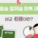 권산부인과의원 | 여자 소중이 사진 비교해 본 내 상태, 소음순돌출 수술 필요할까?
