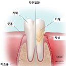 홈플란트치과의원 이미지