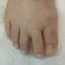 애터미 의왕 ONE 센터 | 의왕 내손동 발톱무좀 60대 아버지 고민 오벨리네일푸스 족보있는그녀들 군포산본점에서 해결한 후기