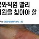 봉와직염 원인 및 재발 이미지