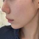 청담안즈피부과의원 이미지