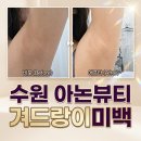 (주)하이리빙 수원프라자 | 수원 아논뷰티 겨드랑이미백 바이뮬리 멜라닌케어 후기