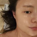 동두천에스테틱 데콜테 맛집 블랑미토탈뷰티의 하이푸 리프팅 후기