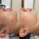 포미에스테틱 네이버블로그