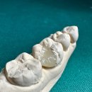 설 치과기공소 이미지