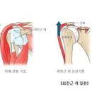 어깨회전근개파열 원인과 증상 치료법까지 이미지