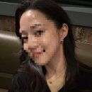 강남 목주름필러:예쁨목주사로 목주름없애기 Before&amp;After 3주차 솔직후기