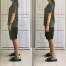 경북메디칼 | 하노버 메디칼 운동센터 &amp; 재활PT| 대구재활운동 대구PT