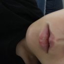 가족사랑 녹십자약국 | 대구 달성군 논공 창고형 대형약국, 365백화점대형약국 내돈내산 후기