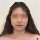 피부, 빛나리 에스테틱