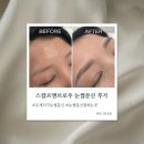은계골드약국 | 시흥 은계지구 눈썹문신 잘하는 곳 스칼프앤브로우 콤보 눈썹문신 솔직 후기