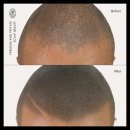 탈모왕 본점 이미지