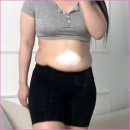 고혈압의 합병증 | 애플워치 고혈압 기능 경험담과 건강관리 솔직후기