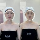 케이엠인증 | 액와관리 단골이 드디어 윤곽까지 케이엠에스테틱 민서 쌤 손길에 정착한 이유